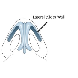 Nose diagram 2